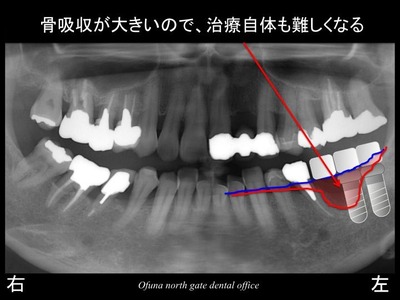 饤10