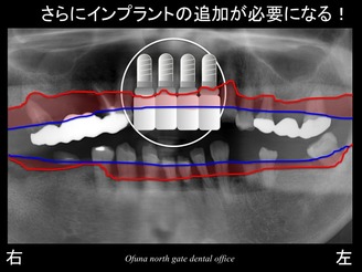 饤14