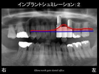 饤14