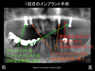 饤21