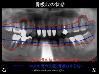 饤02