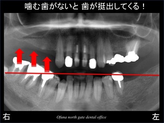 饤04