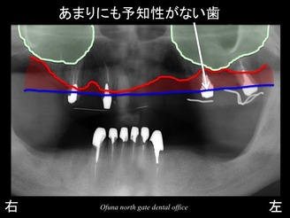 饤19