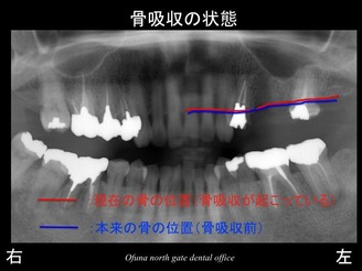 饤16