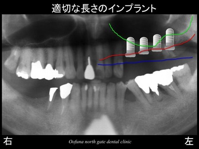 饤6