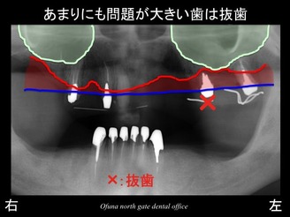 饤20