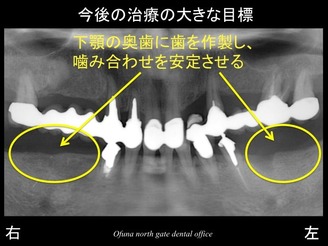 饤10