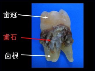 饤1