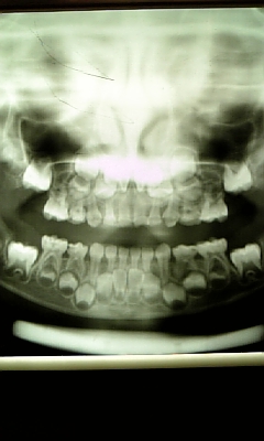 すぅさんの口の中 すぅさんの観察と日々の出来事 すぅさんの口の中 すぅさんの観察と日々の出来事
