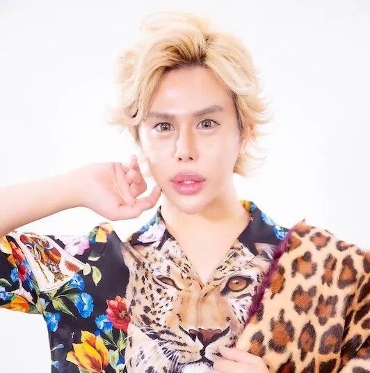 画像 9500万円かけて整形し 無事イケメンになった男がこちらwww Jのログ おんjまとめブログ