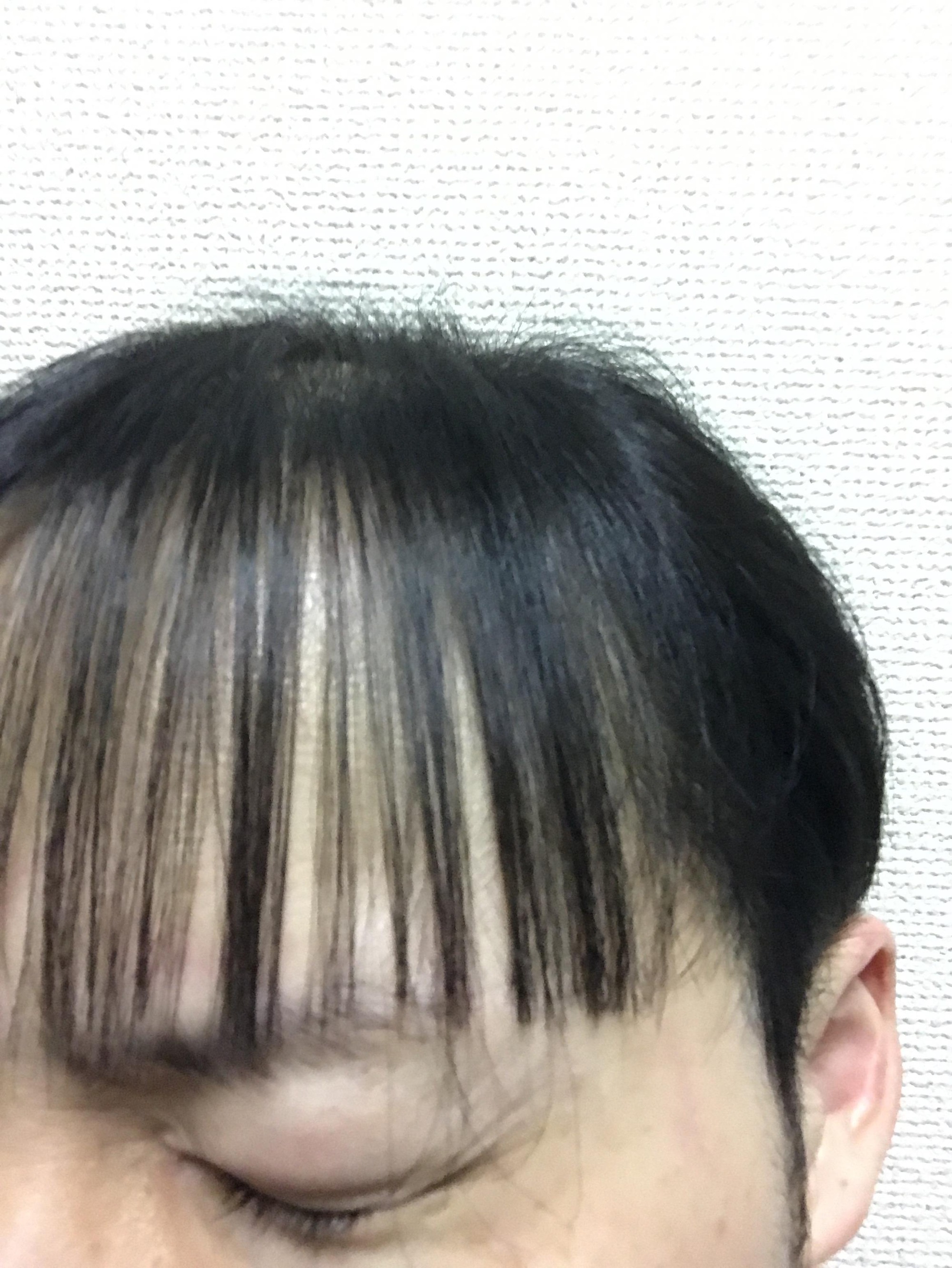 彡 ﾟ ﾟ 1000円カットに行ったらまるでハゲみたいな髪型にされた ありえない Jのログ おんjまとめブログ