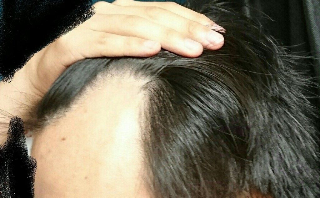 訃報 ワイm字ハゲ とうとうごまかしが効かなくなる Jのログ おんjまとめブログ