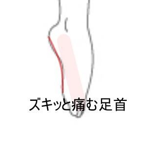 足首
