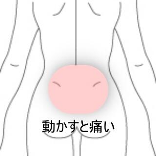 腰痛
