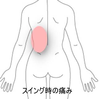 腰背部痛