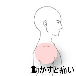 肩の痛み