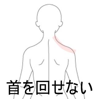 首を回せない