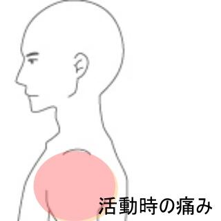 肩の痛み