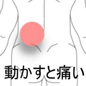 腰痛