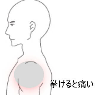 肩の痛み (2)