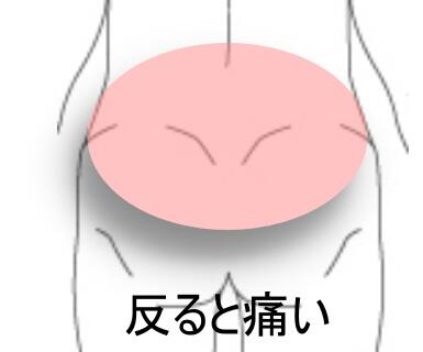 反ると痛い腰
