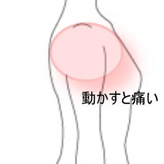 肩の痛み