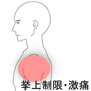腰痛