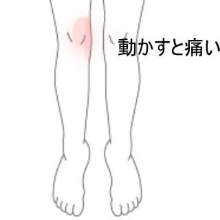 膝の痛み