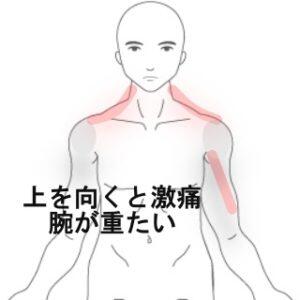 腕の痛み