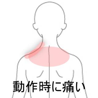 首の痛み