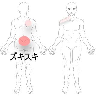 腰の痛み