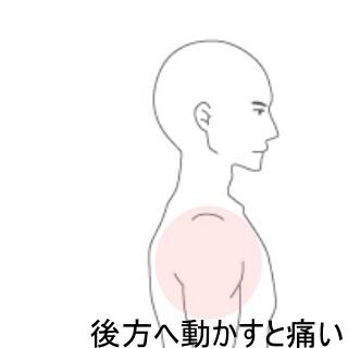 野球肩