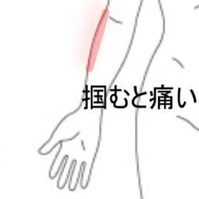 腕の痛み