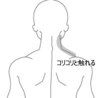 頸の痛み