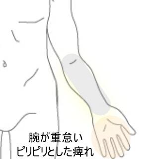 腕の痺れ