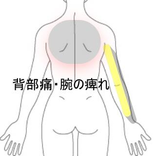 腕の痺れ