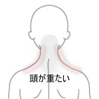 頭痛
