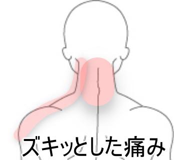 寝違え