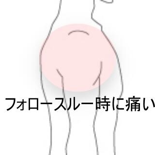 投げるときに痛い