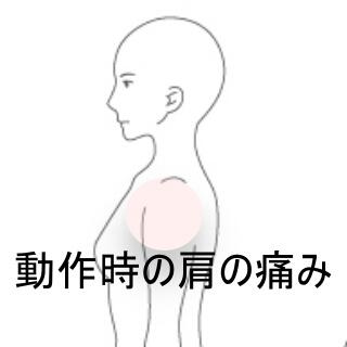 肩の痛み