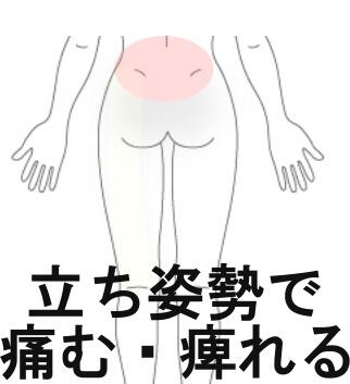 ヘルニア