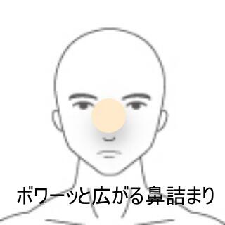 鼻詰まり