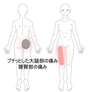 足の痛み