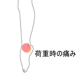 足首痛