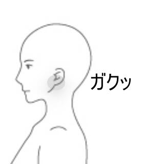 顎関節症