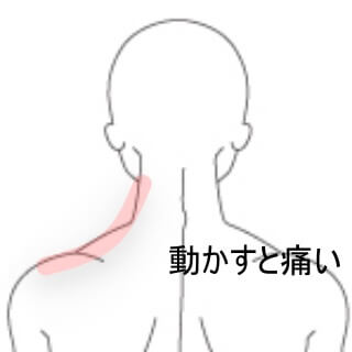 寝違え