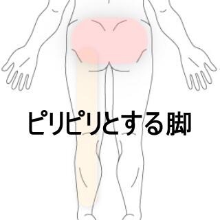 腰痛下肢痛