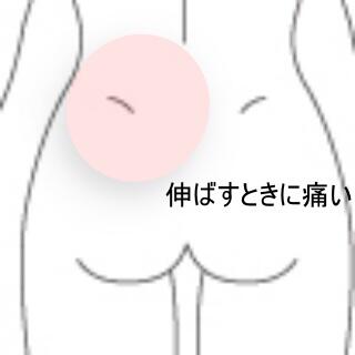 仙腸関節