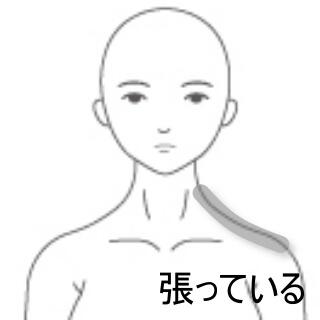 頸の痛み