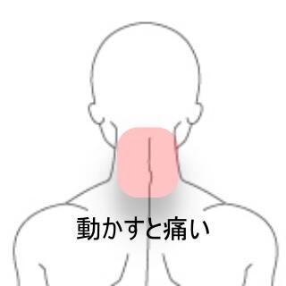 首の痛み